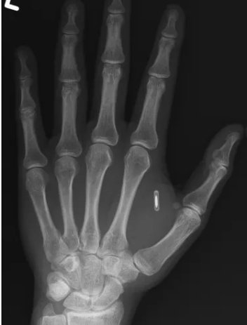 Фокусник забув пароль до власної руки після блокування імплантованого чіпа 3