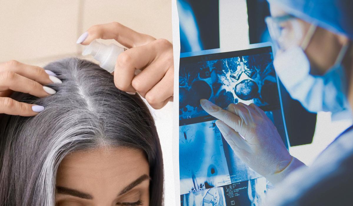 Не переймайтеся через сивину: вчені розкрили несподівану функцію старіння волосся