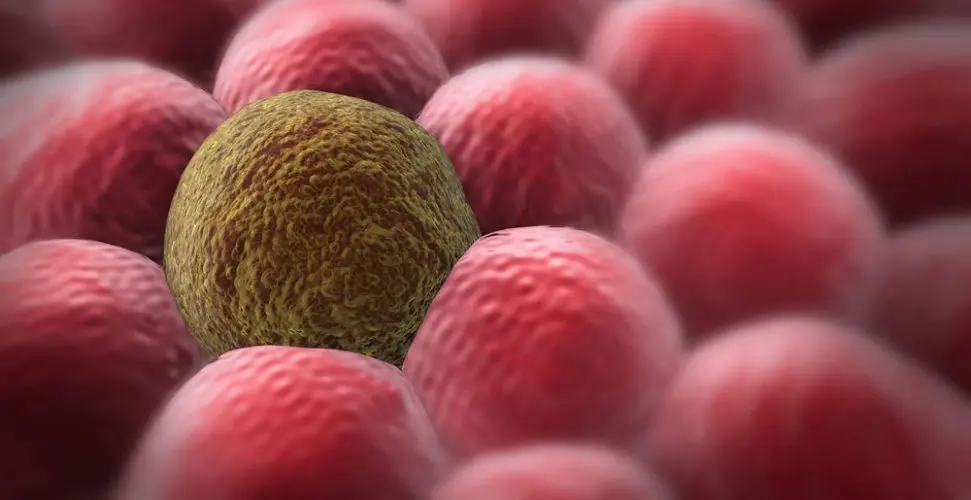 Чи передається рак через кров: розкриваємо наукову правду 1