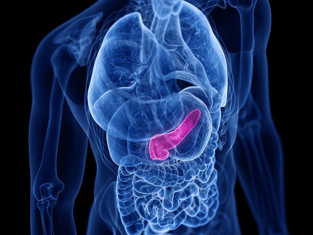 Виживаність при раку підшлункової залози: сучасні реалії та виклики в Україні 4 Виживаність при раку підшлункової залози: сучасні реалії та виклики в Україні 3