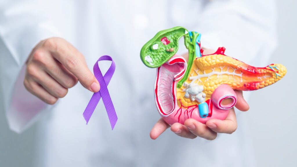 Виживаність при раку підшлункової залози: сучасні реалії та виклики в Україні 8 Виживаність при раку підшлункової залози: сучасні реалії та виклики в Україні 7