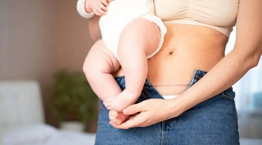 За скільки днів кладуть на планове кесареве розтин 1