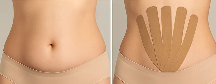 Як клеїти тейпи на живіт: повний гід з техніками 1