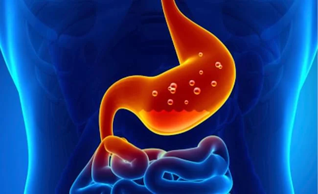 Як підвищити кислотність шлунку: ефективні методи 1