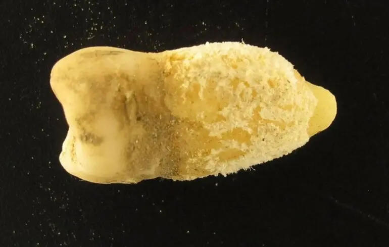 Вчені виявили бактерії скарлатини в зубі мумії з Болівії. 1