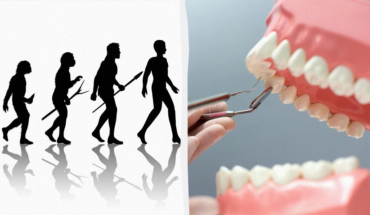 Вчені з'ясували, як зуби мудрості пов'язані з розвитком інтелекту: навіщо вони потрібні